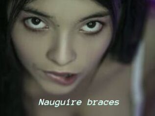 Nauguire_braces